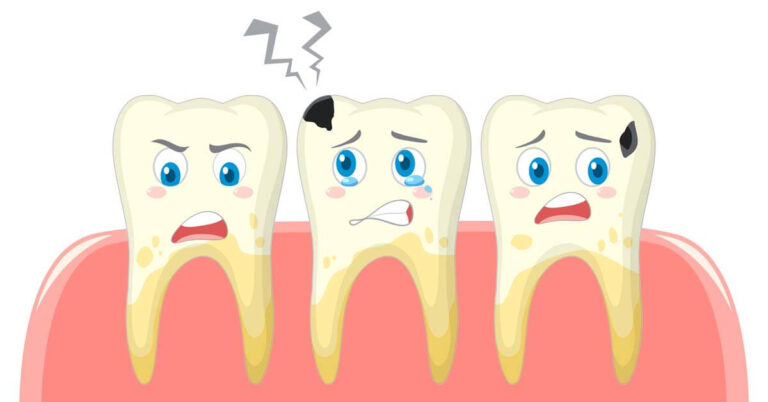 Шүд цайруулах эмчилгээ Prodent Dental Clinic