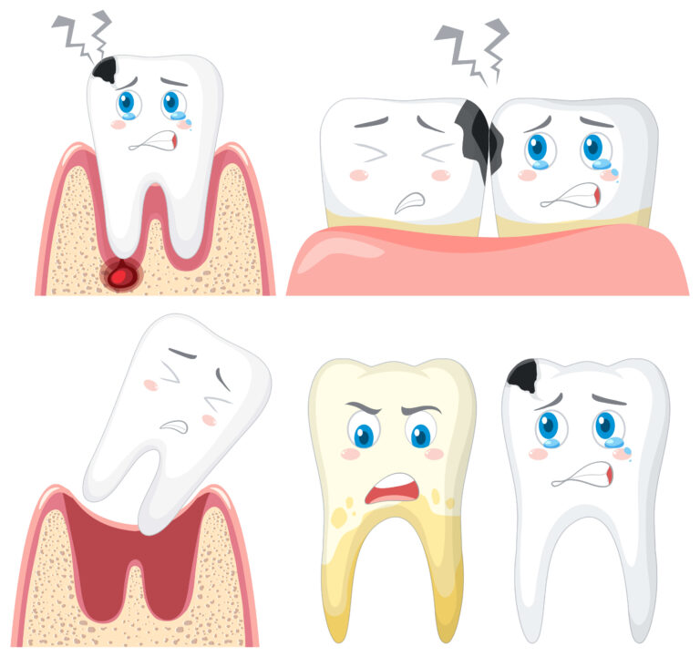 Хөдөлсөн шүд эмчлэх арга буюу таны шүд хөдөлсөн бол яах вэ ?