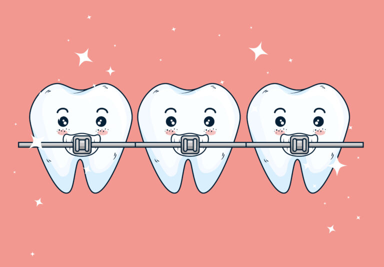 Шүдний гүүрний гэж юу вэ ? Төрөл зүйл , ашиг тус