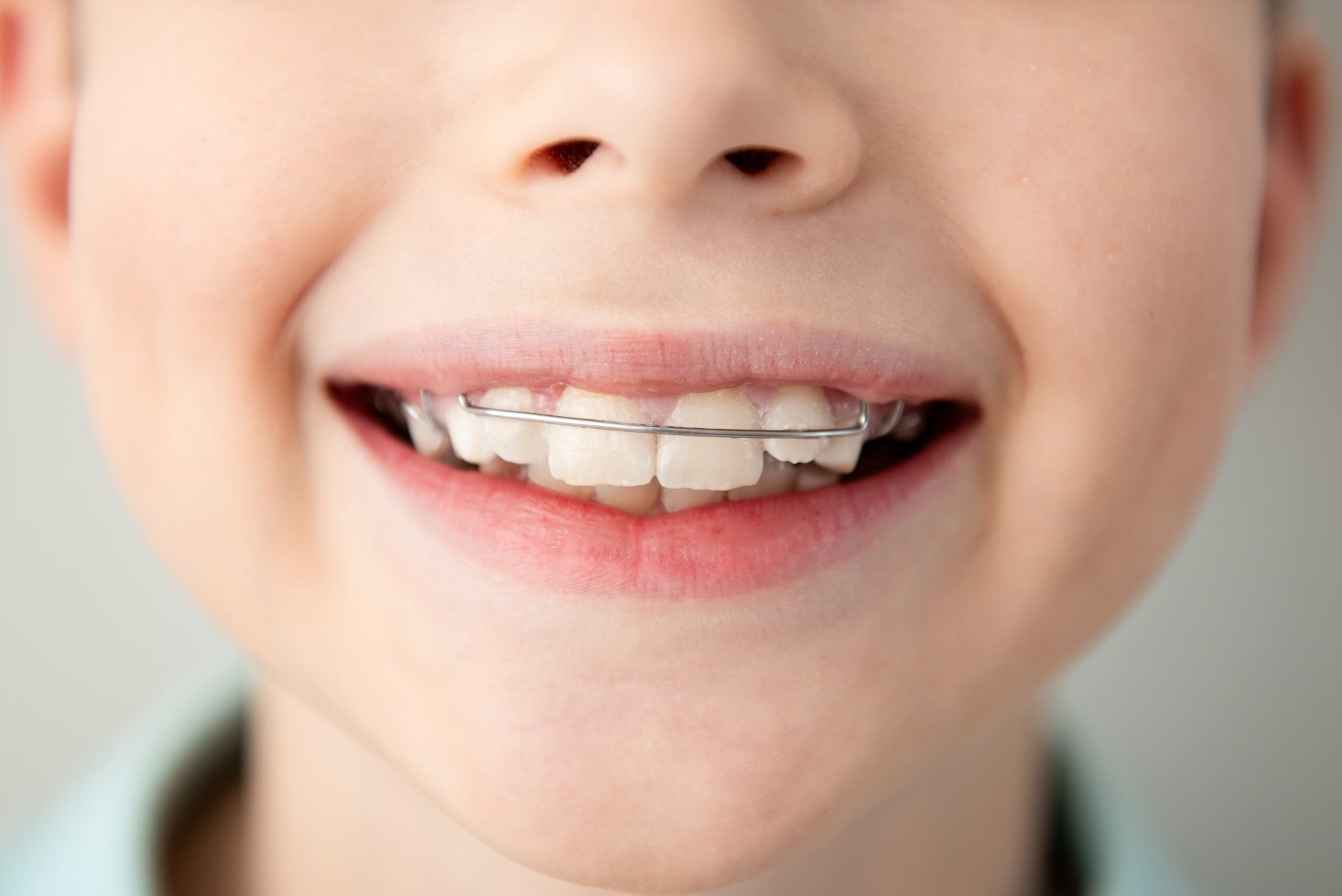 close up portrait of smiling child showing dental 2024 06 07 23 10 45 utc scaled