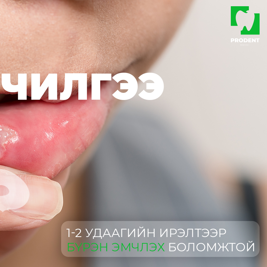 Лазер эмчилгээ: Өвдөлтгүй, хурдан эдгээх орчин үеийн шийдэл 9 Лазер эмчилгээ