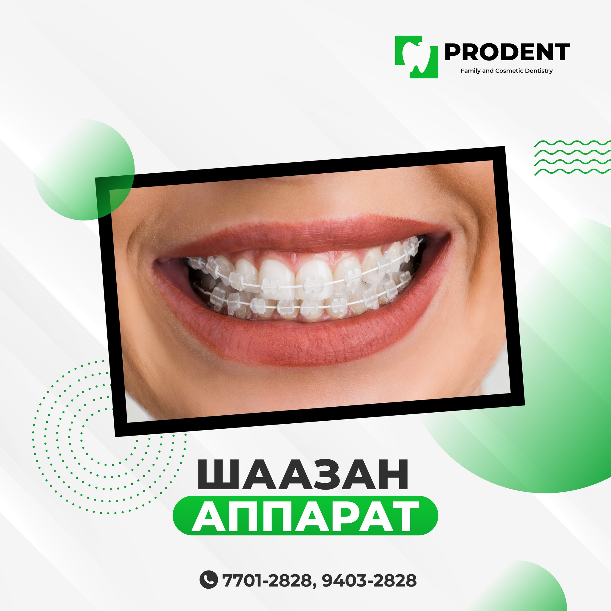 Шаазан аппарат