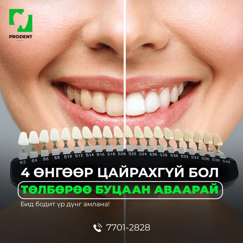 шүд цайруулах