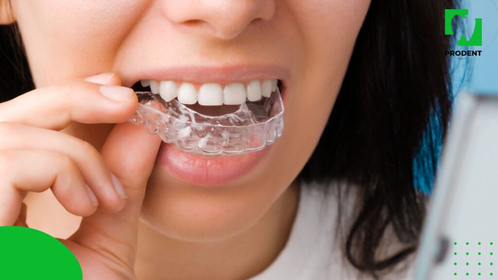 Шүдний бэхжүүлэгч аппарат буюу ретейнерийн үүрэг 1 Шүдний бэхжүүлэгч аппарат буюу ретейнерийн үүрэг