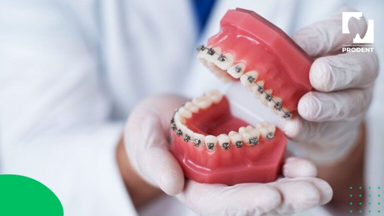 Шүдний аппарат хийлгэх нас