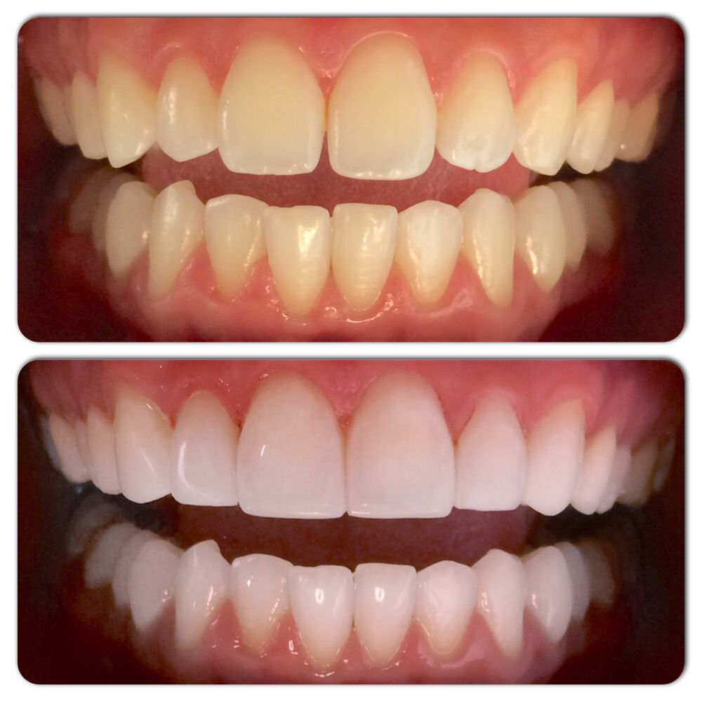 Шүдний эмнэлэг