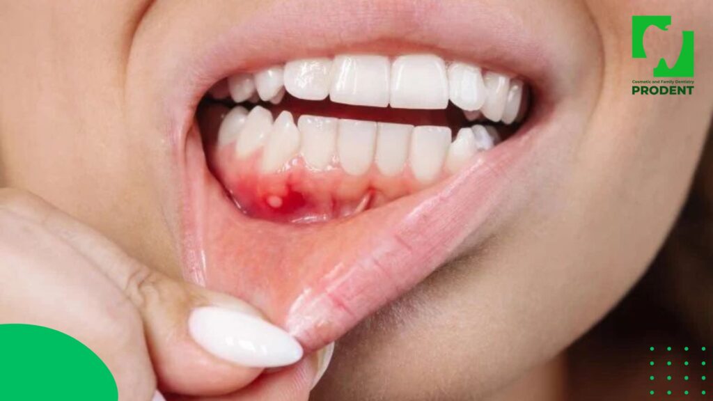 Том хүний ам гэмтэх 7 том хүний ам гэмтэх