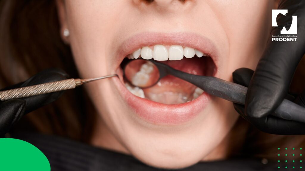 Шүд цоорох шалтгаан 6 Шүд цоорох шалтгаан