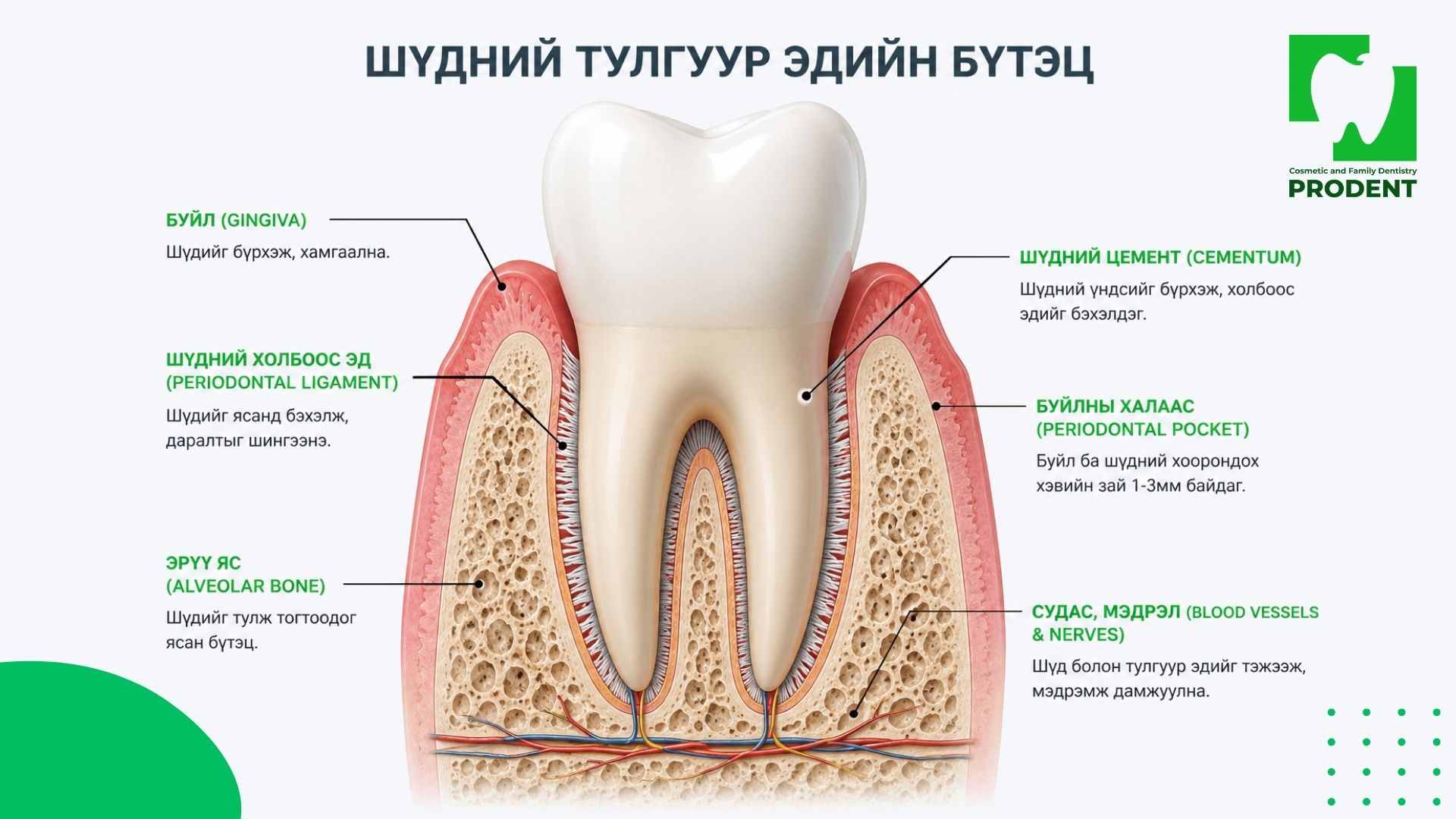Буйлны үрэвсэл эмчлэх арга 6 шүдний тулгуур эдийн үрэвсэл