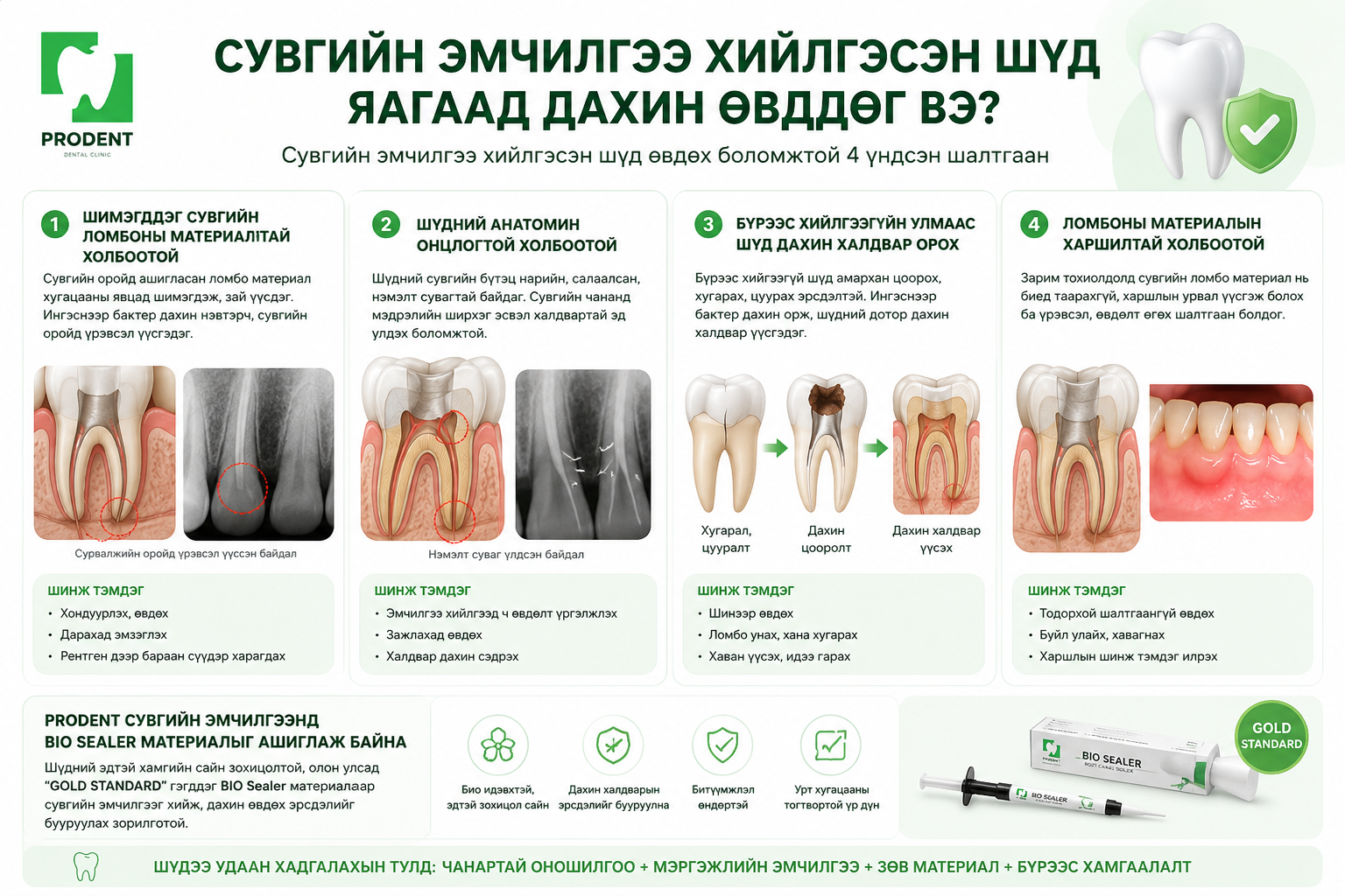 Сувгийн эмчилгээ хийлгэсэн шүд өвдөх