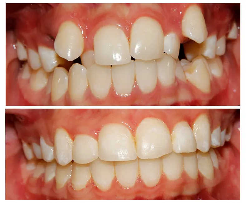 Prodent Dental Clinic Шүдний эмнэлэг 42 Шүдний эмнэлэг