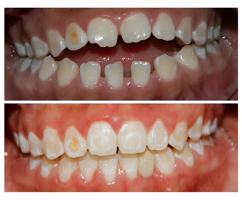 Prodent Dental Clinic Шүдний эмнэлэг 41 Шүдний эмнэлэг
