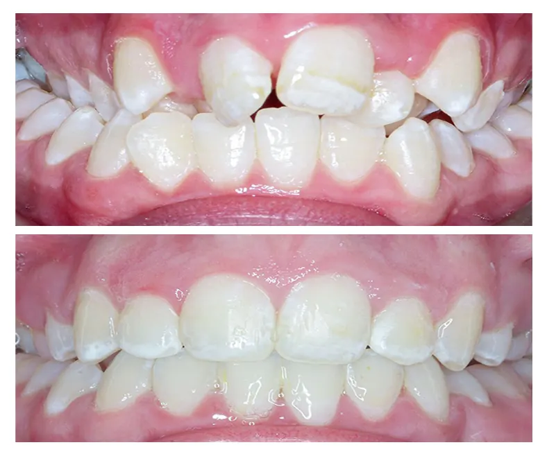Prodent Dental Clinic Шүдний эмнэлэг 40 Шүдний эмнэлэг