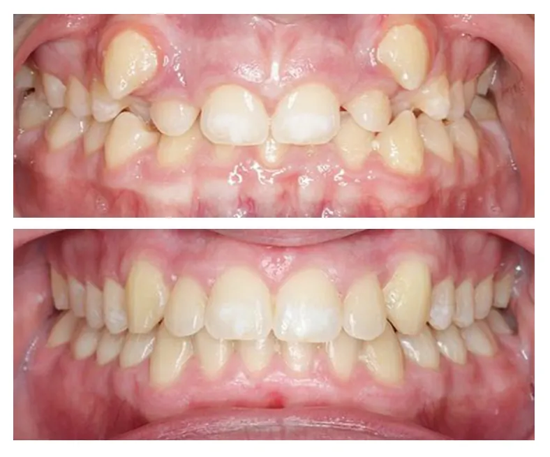 Prodent Dental Clinic Шүдний эмнэлэг 39 Шүдний эмнэлэг