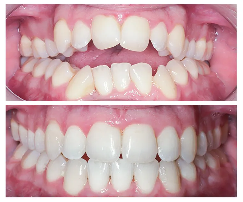 Prodent Dental Clinic Шүдний эмнэлэг 38 Шүдний эмнэлэг