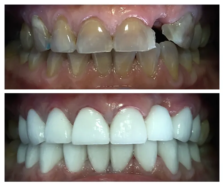 Prodent Dental Clinic Шүдний эмнэлэг 36 Шүдний эмнэлэг