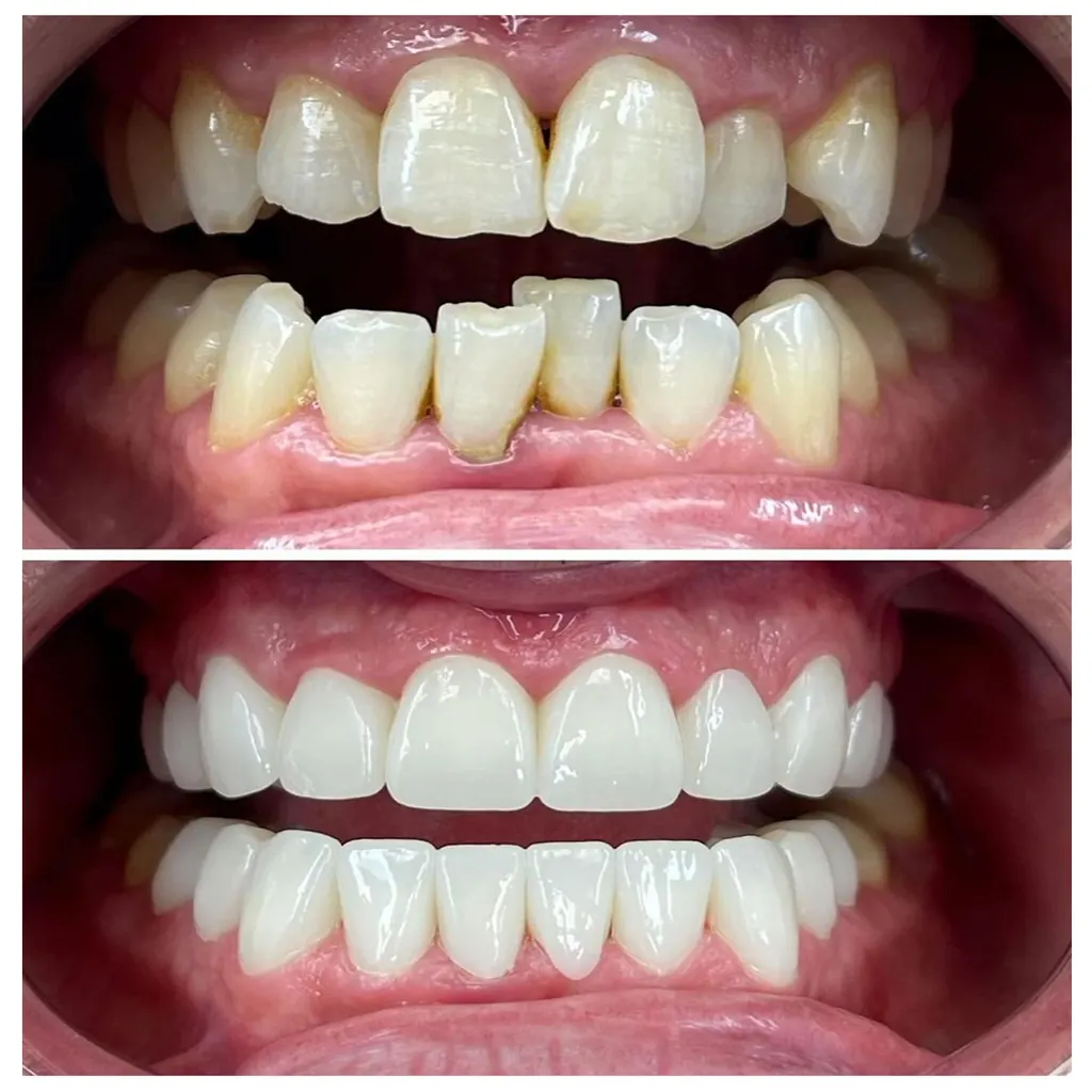 Prodent Dental Clinic Шүдний эмнэлэг 35 Шүдний эмнэлэг