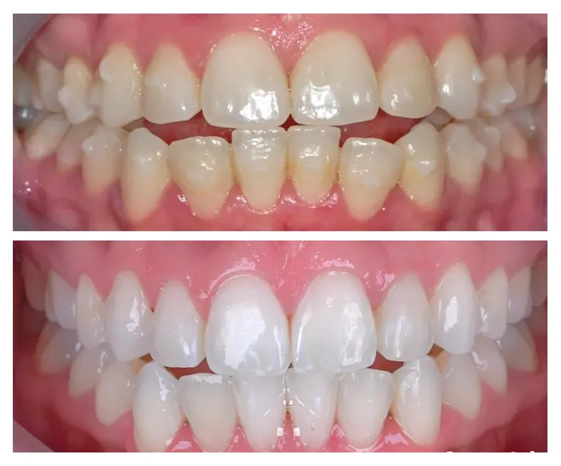 Prodent Dental Clinic Шүдний эмнэлэг 33 Шүдний эмнэлэг